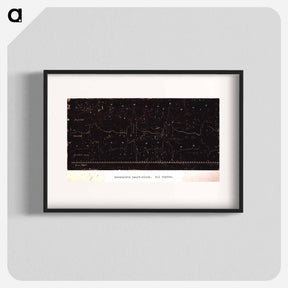 アートポスター-Electrocardiograph of Incomplete Heart Block
 - 国立医学図書館 Poster.