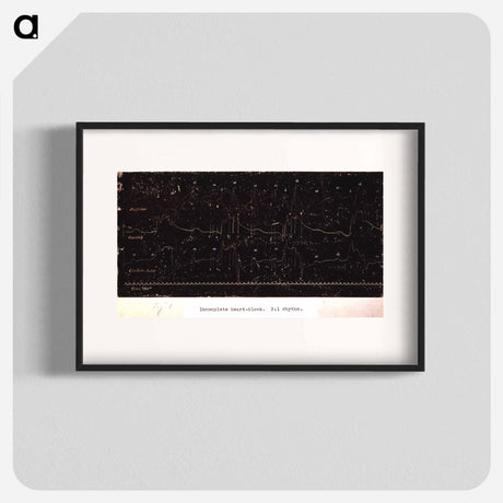 アートポスター-Electrocardiograph of Incomplete Heart Block
 - 国立医学図書館 Poster.