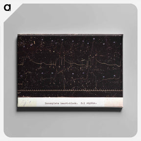 アートパネル-Electrocardiograph of Incomplete Heart Block
 - 国立医学図書館 Canvas.
