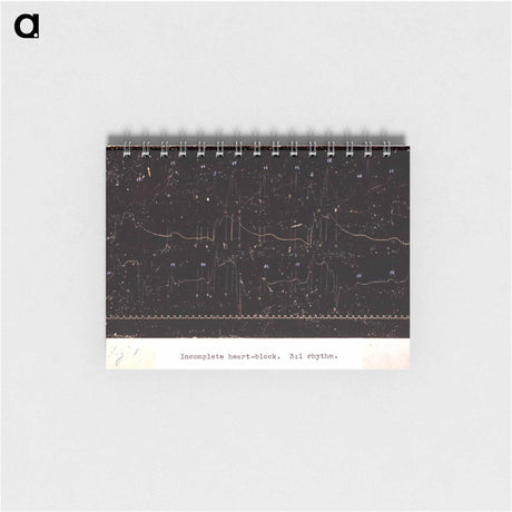 アートメモ帳-Electrocardiograph of Incomplete Heart Block
 - 国立医学図書館 Memo.