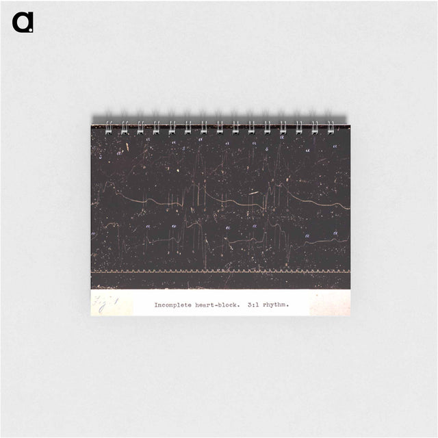 アートメモ帳-Electrocardiograph of Incomplete Heart Block
 - 国立医学図書館 Memo.