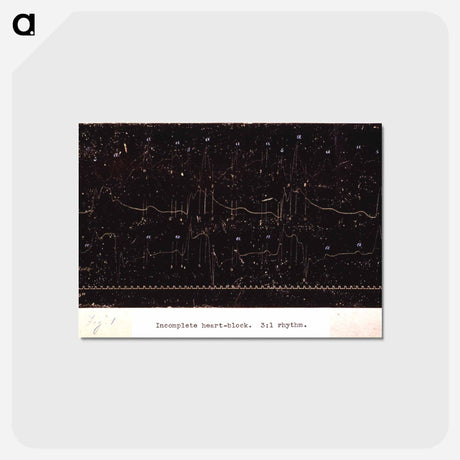 アートポストカード-Electrocardiograph of Incomplete Heart Block
 - 国立医学図書館 Postcard.