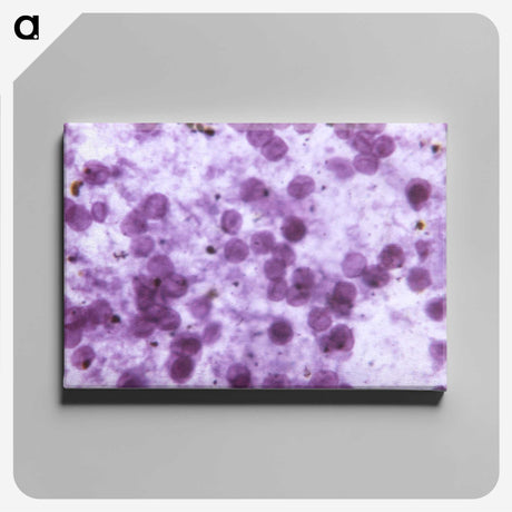 2-27_COVID-19_canvas