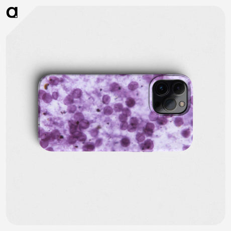 2-27_COVID-19_phone