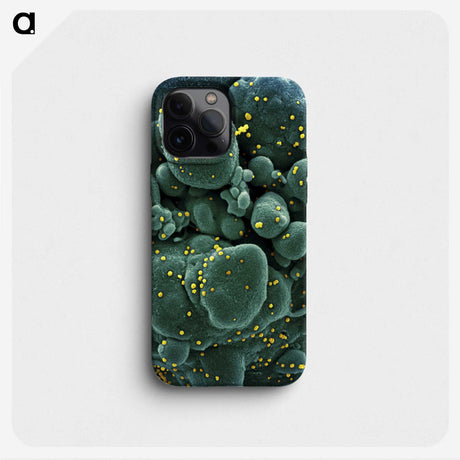2-29_COVID-19_phone