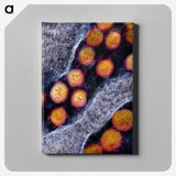 2-31_COVID-19_canvas