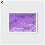 2-32_COVID-19_hagaki