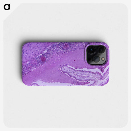 2-32_COVID-19_phone