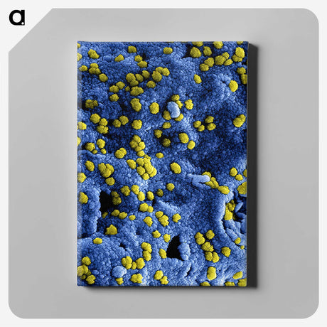 2-36_COVID-19_canvas