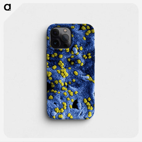 2-36_COVID-19_phone