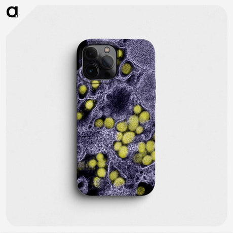 2-37_COVID-19_phone