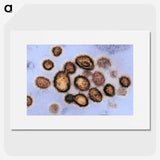 2-40_COVID-19_picture