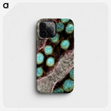 2-46_COVID-19_phone