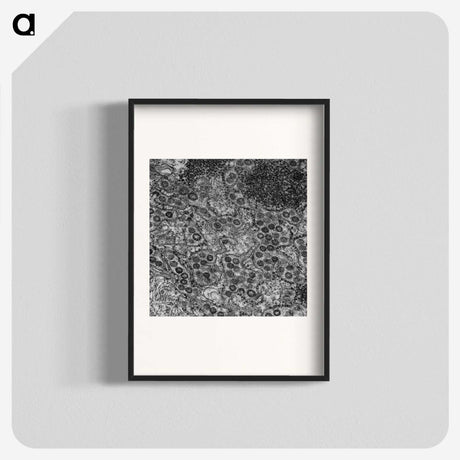 2-57_COVID-19_blk