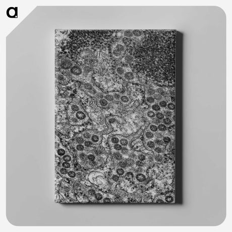 2-57_COVID-19_canvas