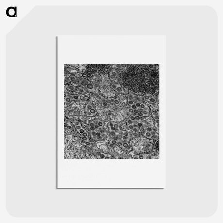 2-57_COVID-19_hagaki