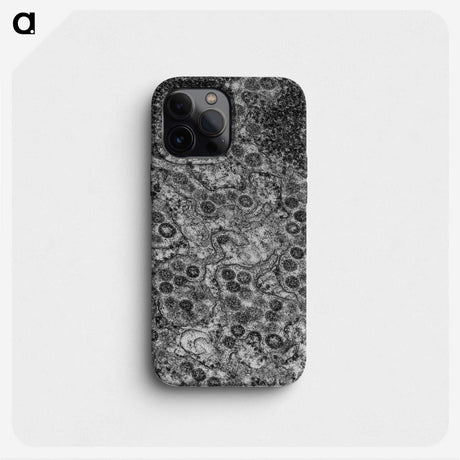 2-57_COVID-19_phone