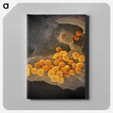 2-60_COVID-19_canvas