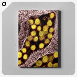 2-62_COVID-19_canvas