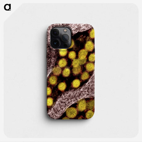 2-62_COVID-19_phone
