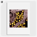 2-62_COVID-19_picture