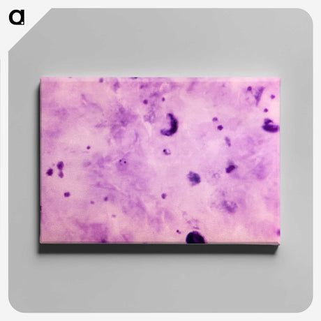 3-10_COVID-19_canvas