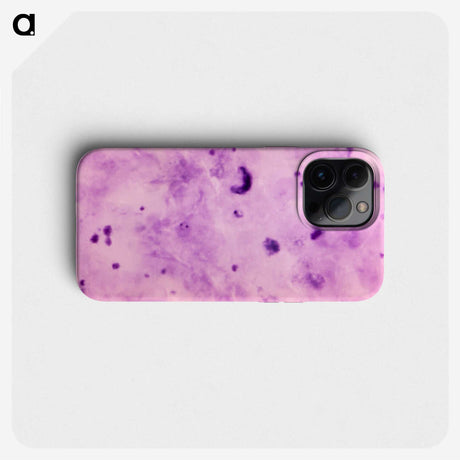 3-10_COVID-19_phone