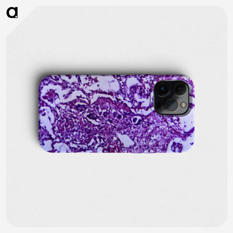 3-12_COVID-19_phone