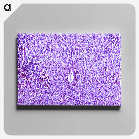 3-13_COVID-19_canvas