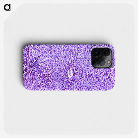3-13_COVID-19_phone