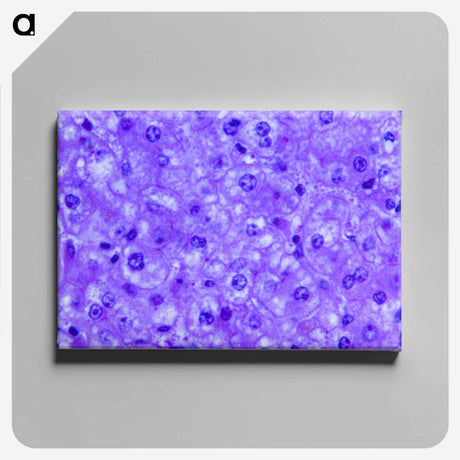 3-14_COVID-19_canvas