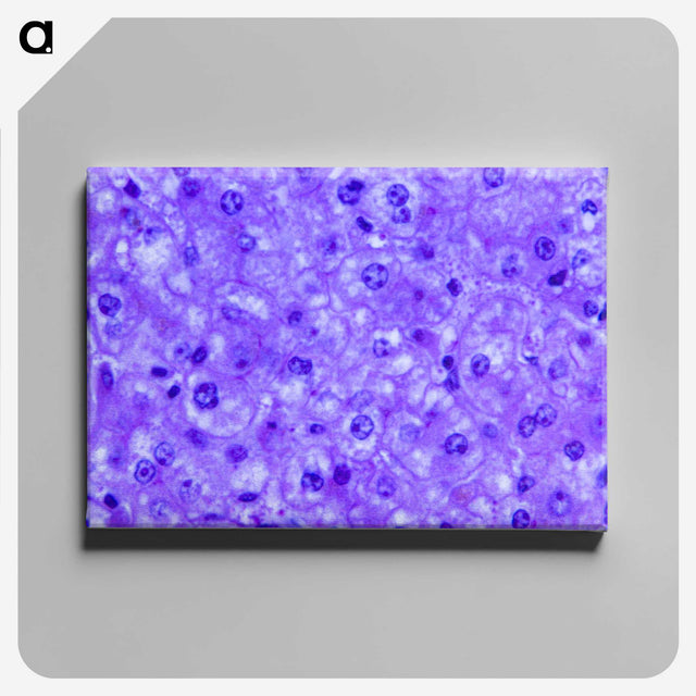3-14_COVID-19_canvas