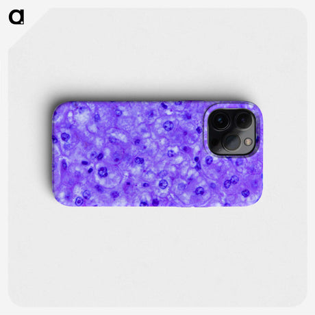 3-14_COVID-19_phone