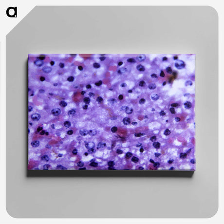3-16_COVID-19_canvas
