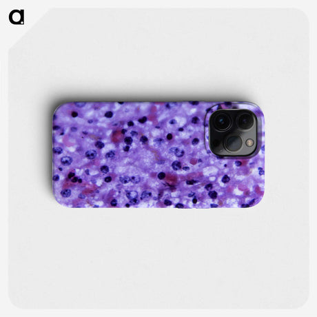 3-16_COVID-19_phone