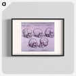 アートポスター-Bone Plate: Five Malformations of the Skull
 - 国立医学図書館 Poster.