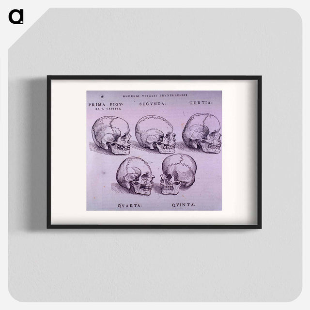 アートポスター-Bone Plate: Five Malformations of the Skull
 - 国立医学図書館 Poster.