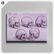 アートパネル-Bone Plate: Five Malformations of the Skull
 - 国立医学図書館 Canvas.