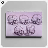 アートパネル-Bone Plate: Five Malformations of the Skull
 - 国立医学図書館 Canvas.