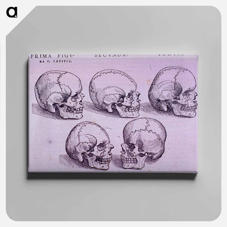 アートパネル-Bone Plate: Five Malformations of the Skull
 - 国立医学図書館 Canvas.