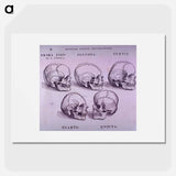 アートポスター-Bone Plate: Five Malformations of the Skull
 - 国立医学図書館 Poster.