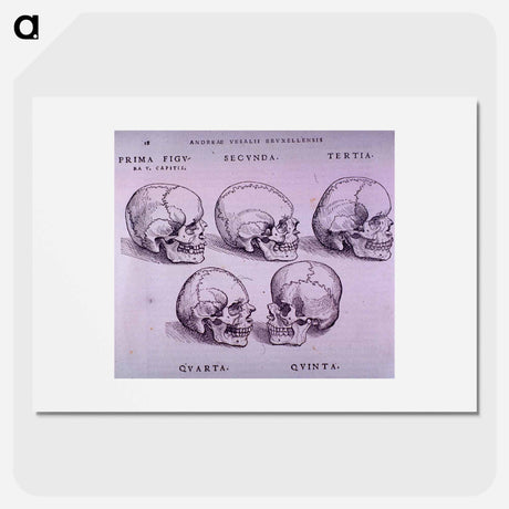 アートポスター-Bone Plate: Five Malformations of the Skull
 - 国立医学図書館 Poster.