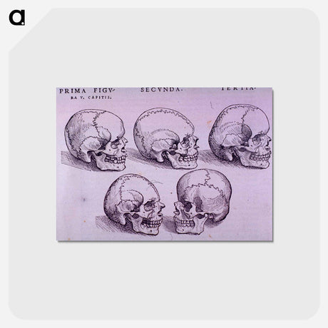 アートポストカード-Bone Plate: Five Malformations of the Skull
 - 国立医学図書館 Postcard.