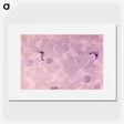 3-63_COVID-19_picture