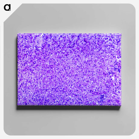 3-7_COVID-19_canvas
