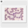 3-9_COVID-19_picture