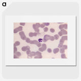 3-9_COVID-19_picture