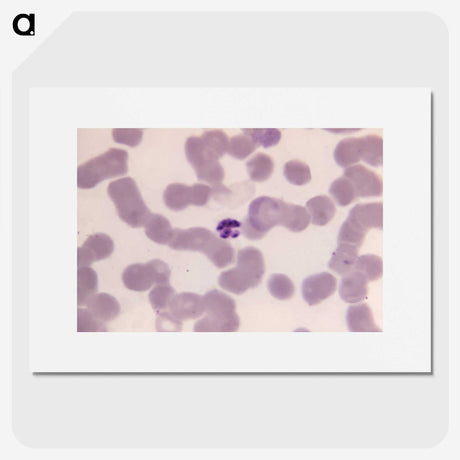 3-9_COVID-19_picture