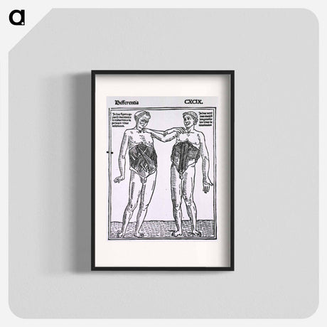 アートポスター-Abdominal Muscles
 - 国立医学図書館 Poster.
