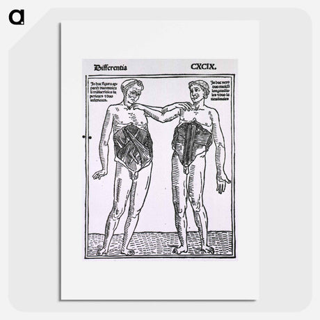 アートポスター-Abdominal Muscles
 - 国立医学図書館 Poster.